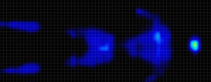 Ikea Vesteroy Pressure Map Back Ikea Vesteroy Pressure Map Back