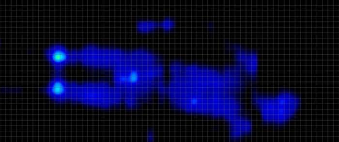 Big Fig Pressure Map Stomach Big Fig Pressure Map Stomach