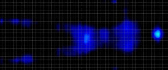 Novilla Serenity Pressure Map Back