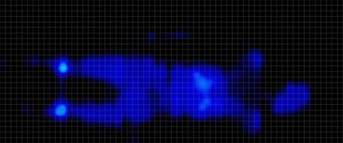 Novilla Serenity Pressure Map Stomach