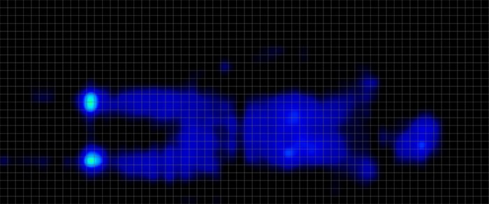 Awara 2024 Pressure Map Test Stomach