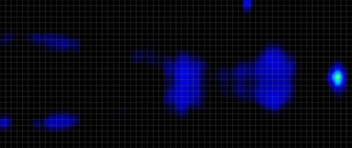 Novaform Dreamaway Pressure Mapping Back