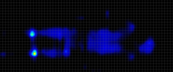 Novaform Dreamaway Pressure Mapping Stomach