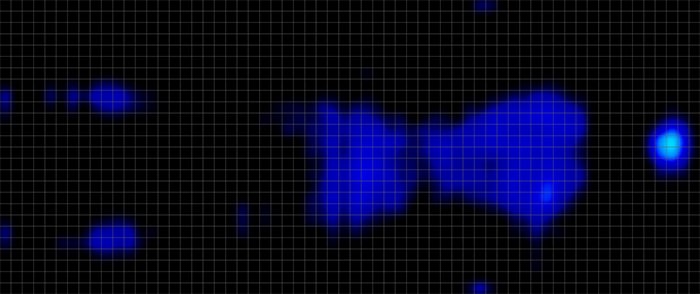 Purple Renew Pressure Map Back Purple Renew Pressure Map Back