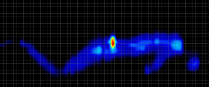 Purple Renew Pressure Map Side 2 Purple Renew Pressure Map Side 2