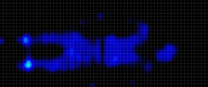 Purple Renew Pressure Map Stomach Purple Renew Pressure Map Stomach