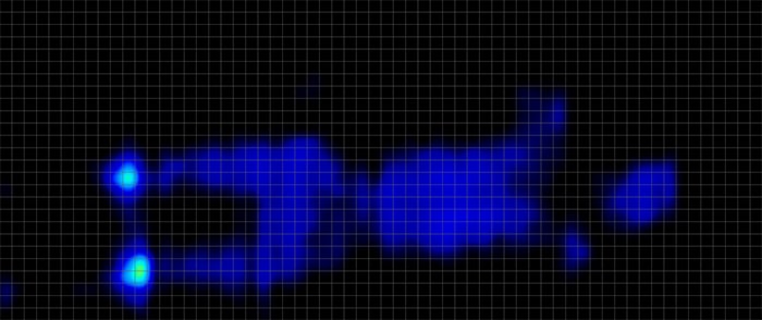 My Green Mattress Kiwi Pressure Map Stomach