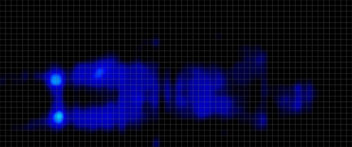 Vesgantti Pressure Map Stomach