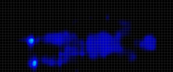 Helix Moonlight Luxe Pressure Map Stomach