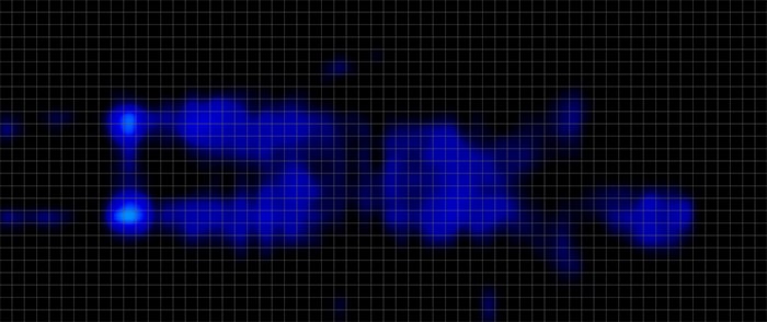 Helix Moonlight Elite Pressure Map Stomach