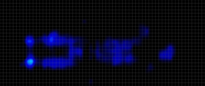 Tiami 2025 Pressure Map Stomach