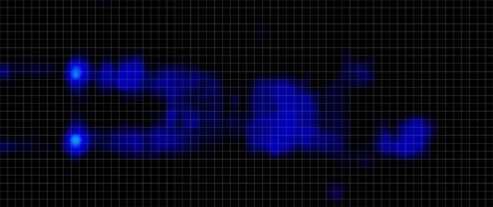 Diamond Dreamstage Pressure Map Stomach Diamond Dreamstage Pressure Map Stomach