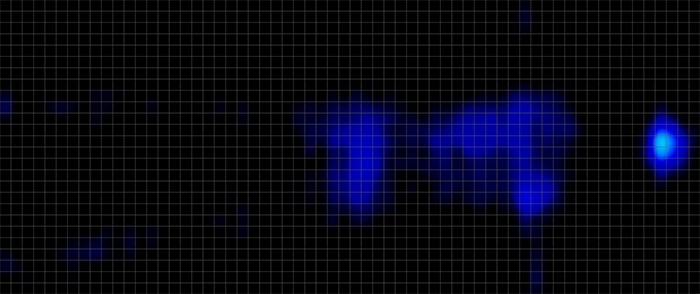Avocado Luxury Pressure Map Back