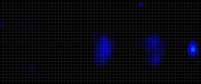 Novaform Advanced Back Support Plus Pressure Map Back