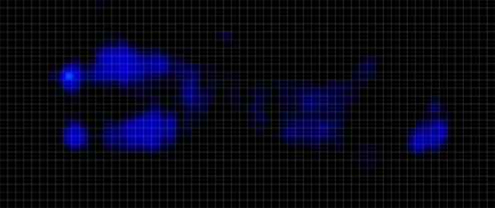 Sonu Pressure Map Stomach
