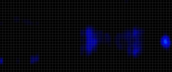 Winkbed Plus Pressure Map Back Winkbed Plus Pressure Map Back