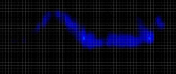 Winkbed Plus Pressure Map Side Winkbed Plus Pressure Map Side