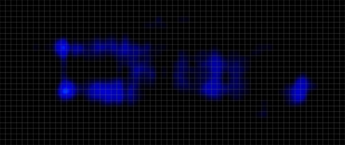 Winkbed Plus Pressure Map Stomach Winkbed Plus Pressure Map Stomach