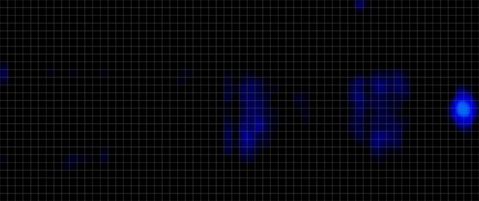 Dreamcloud Pressuresmart Pressure Map Back
