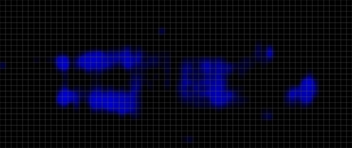 Dreamcloud Pressuresmart Pressure Map Stomach