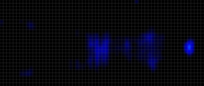 Winkbed Pressure Map Back Winkbed Presssure Map Back